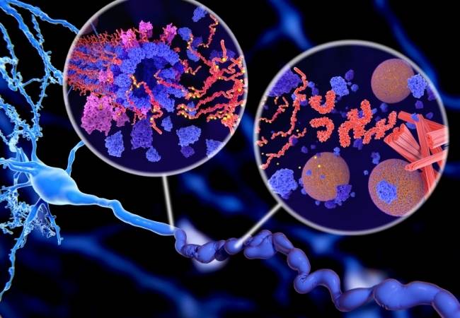 Além dos testes, também é imprescindível fazer exames de imagens para constatar o diagnóstico