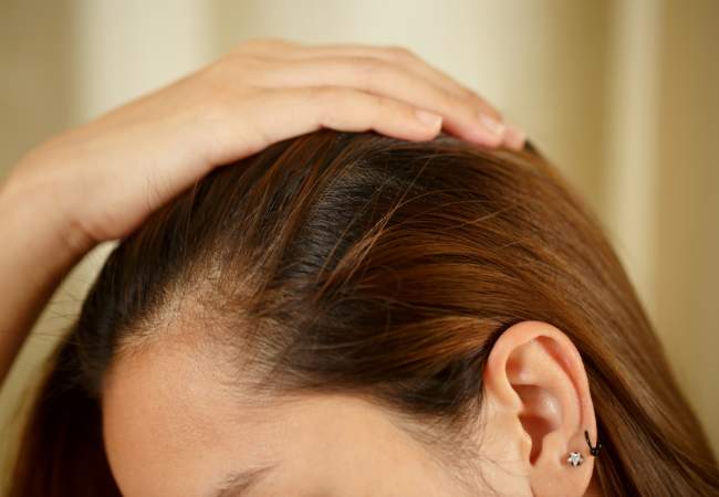 Tratamento natural contra psoríase