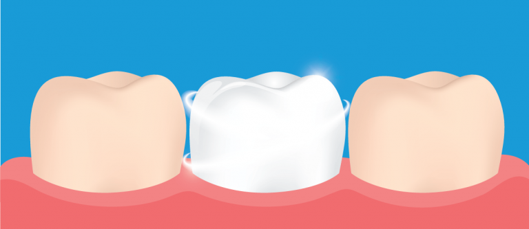 clareamento nos dentes